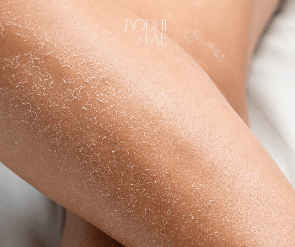 Gentle skincare collection for sensitive dry and irritated skin
